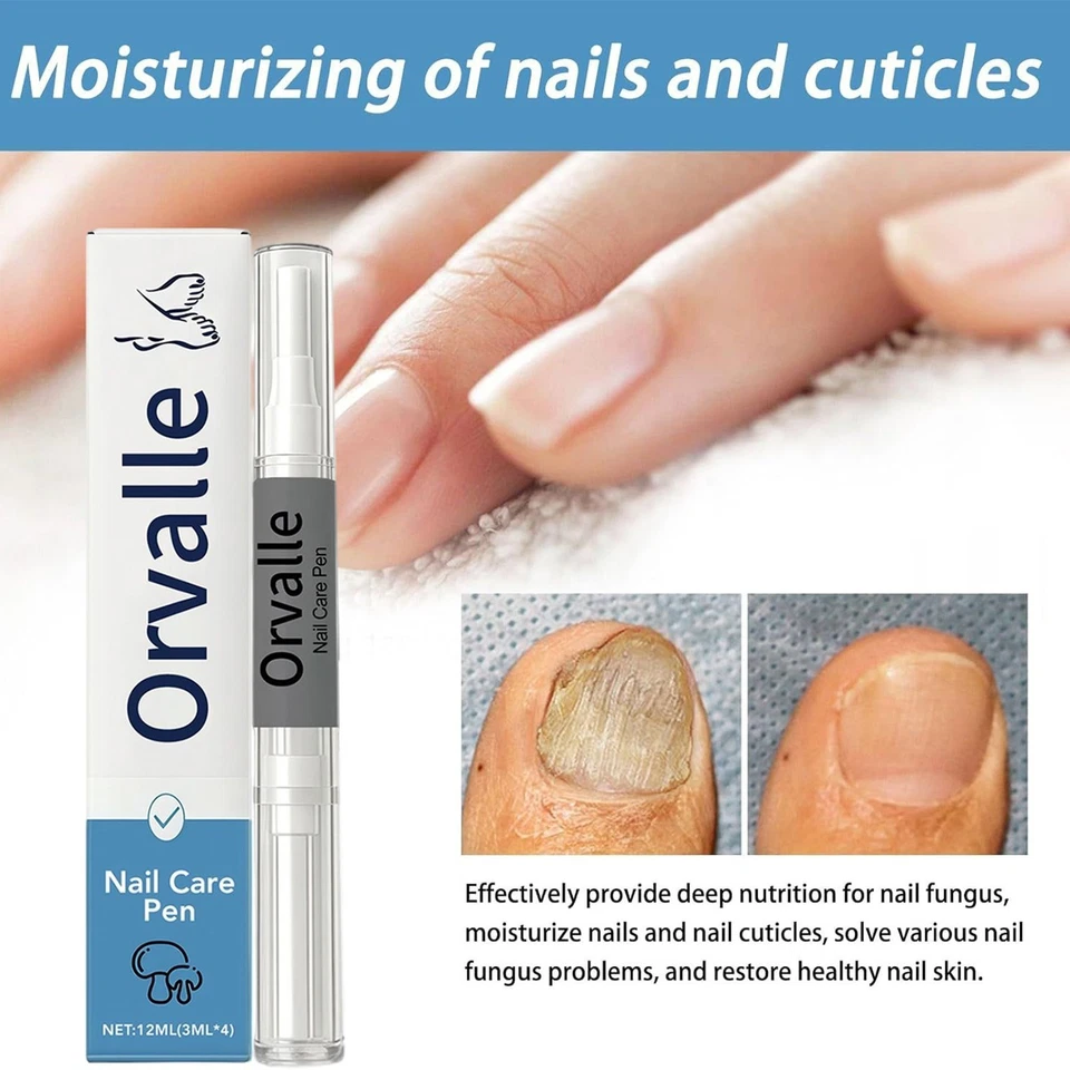 Orville Nagelpilz-Stift, 4 Stück, Nagelpflege-Reparaturstift DE - Bild 2 von 4