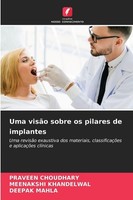 Uma VisãO Sobre Os Pilares De Implantes Praveen Choudhary