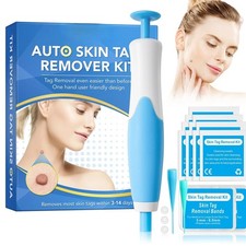 Auto Micro Skin Tag Remover Device Kit Safe Painless Removal 2-8 mm Band Tool