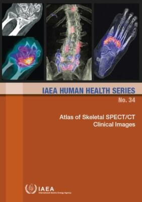 Atlas of Skeletal SPECT/CT Clinical Images (IAEA Human Health Series), Internati