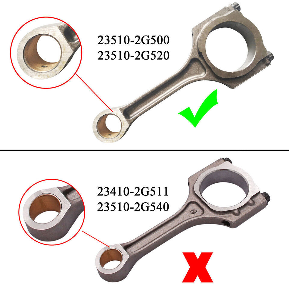 For Hyundai Sonata Kia Optima 2.4L Engine Crankshaft Connecting Rod Piston Kit eBay