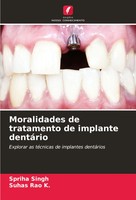 Moralidades De Tratamento De Implante DentáRio Spriha Singh (U. A.) Taschenbuch