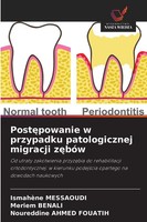 IsmahèNe Messaoudi (U. A.) | Post¿Powanie W Przypadku Patologicznej Migracji...