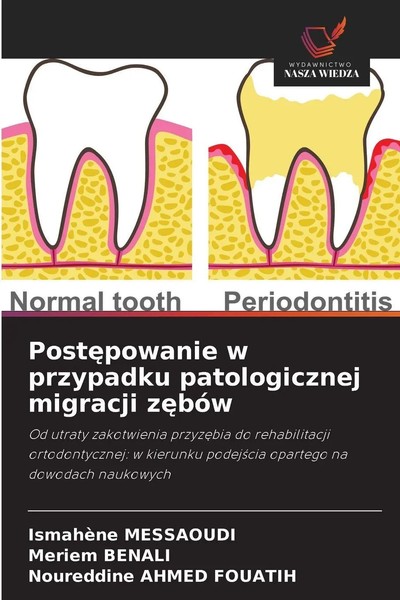 IsmahèNe Messaoudi (U. A.) | Post¿Powanie W Przypadku Patologicznej Migracji...-image