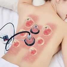 12 Cups Electric Vacuum Cupping Body Suction Scraping Massager Pain Relief