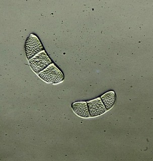 Antique microscope slide by Watson. Diatoms. Euodia frauenfeldii.