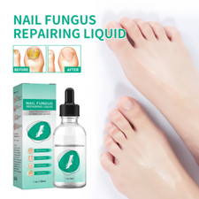 1-10PCS New Kerassentials Toenail Treatment Oil, Natural Nail Care Liquid US
