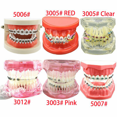 Dental Orthodontic Teeth Model With Bracket Tube /Arch Wire/Self-ligating Chain