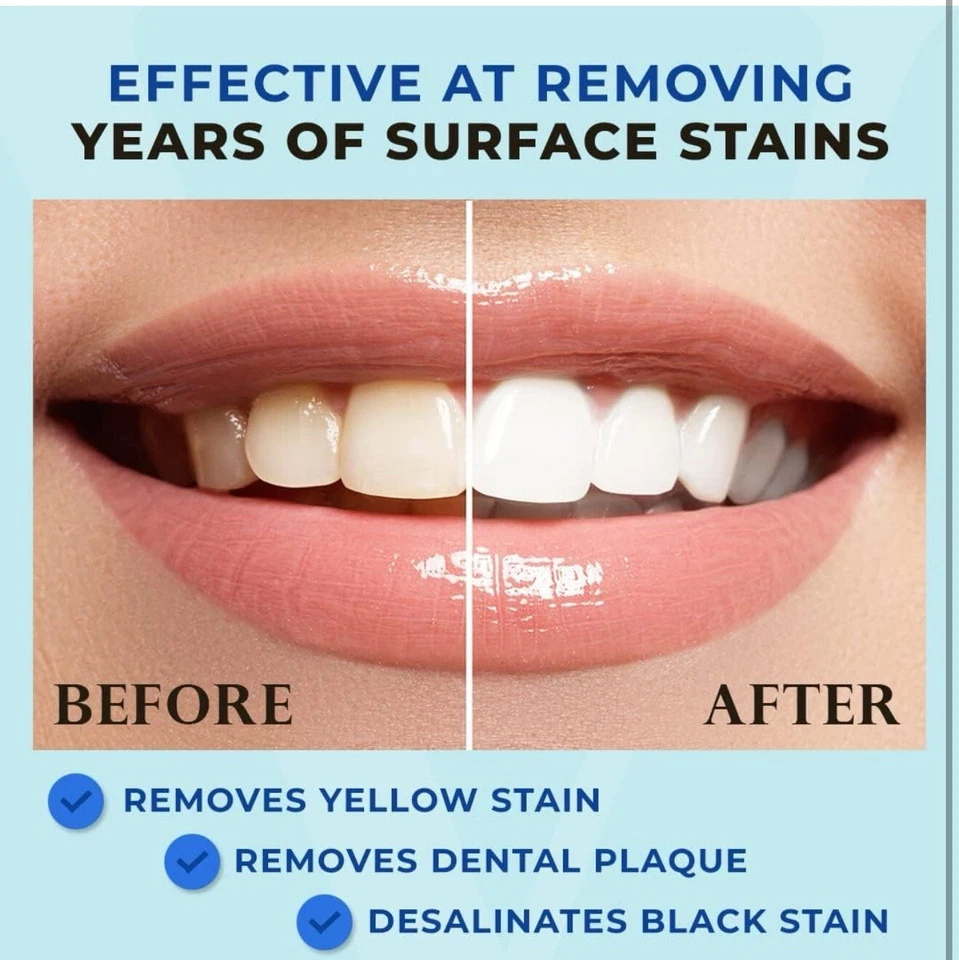 Venus Visage Award 获奖牙齿美白笔,6 笔 13.99 !! 好评论! — 第 2/4 张图片