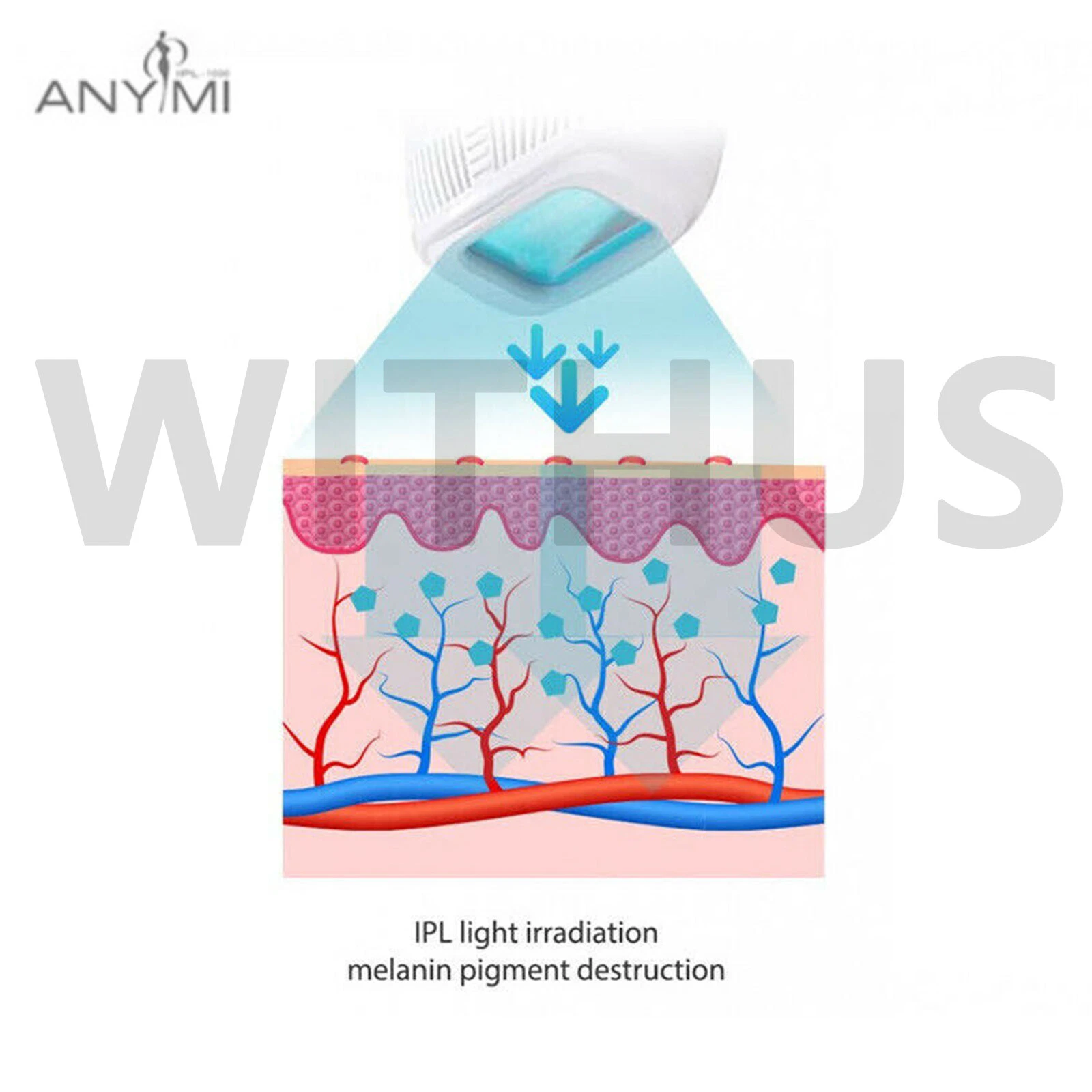 Anymi IPL-2000 Hair Removal Arm Leg Armpit Light Therapy Cartridge Replaceable - Picture 7 of 8