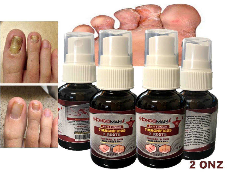 HEALMUSZ Maximum Strength Antifungal Liquid – Toenail Fungus & Athlete's Foot Treatment, All-Natural, 30ml