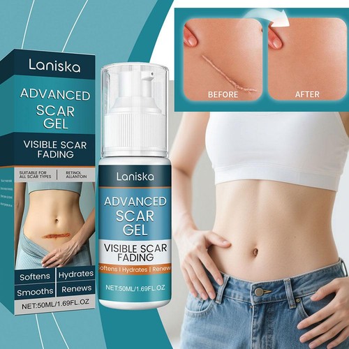 50ml Scar Fading Acne Cream Silicone Removal Fade Old New Treatments Body - Picture 7 of 12