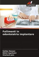 Sahba Hassan (U. A.) | Fallimenti In Odontoiatria Implantare | Taschenbuch