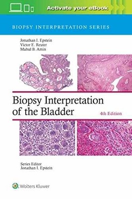 Biopsy Interpretation of the - Hardcover, by Epstein Jonathan I.; - New h