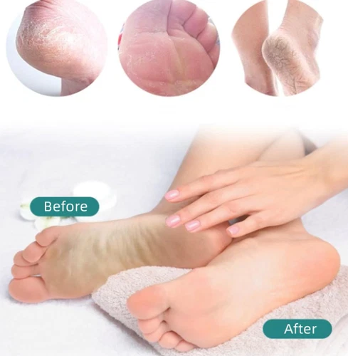 Callus Dead Skin Remover Nano Glass Foot File Unisex - Picture 7 of 13