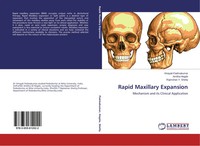 Vinayak Padmakumar (U. A.) | Rapid Maxillary Expansion | Taschenbuch | Englisch