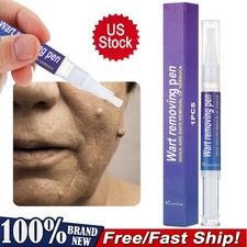 Skin Tag Remover Pen Skin Tag Hand Wart Dark Spot Remover Sticker Painless Safe