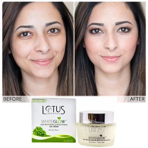 lotus skin lightening cream