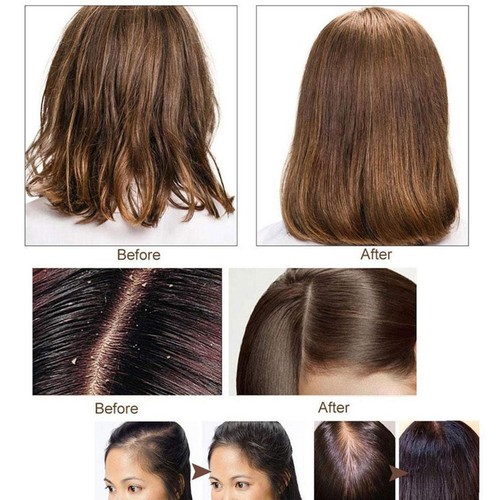 3pcs Organic Ginger Hair Regrowth Shampoo Bar Anti Hair Loss Ginger Shampoo Soap - Picture 9 of 15