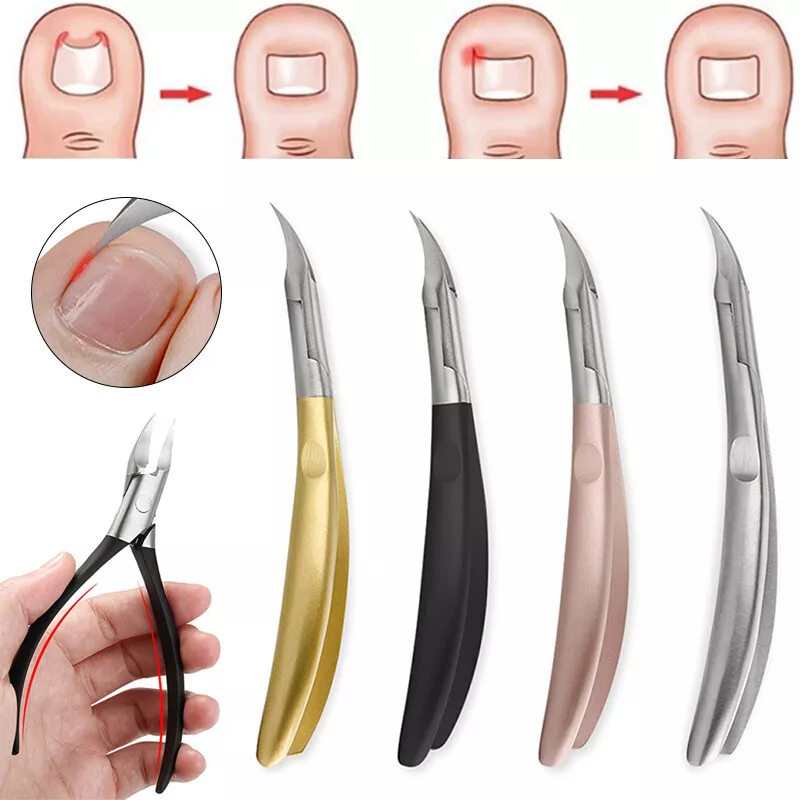 Ingrowing toe nail clippers deals