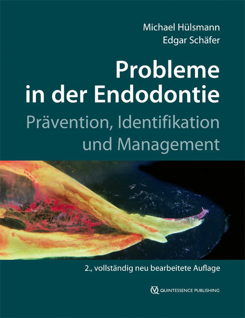 Thumbnail - Michael Hülsmann; Edgar Schäfer / Probleme In Der Endodontie