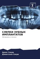 Arpit Sikri (U. A.) | Slepki Zubnyh Implantatov | Taschenbuch | Russisch (2022)