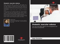 Diabetic Macular Edema Hajar Boutahar