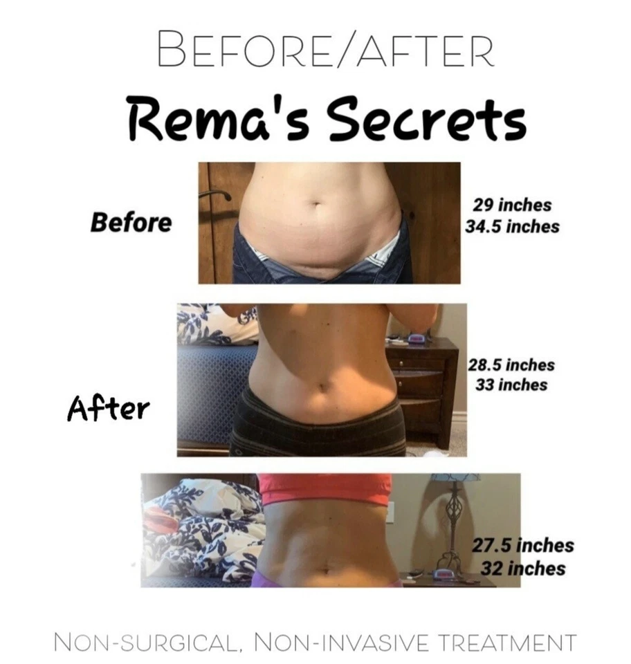 Envolturas corporales de algas del Mar Muerto funciona increíble pérdida de peso  Foto 3 de 4