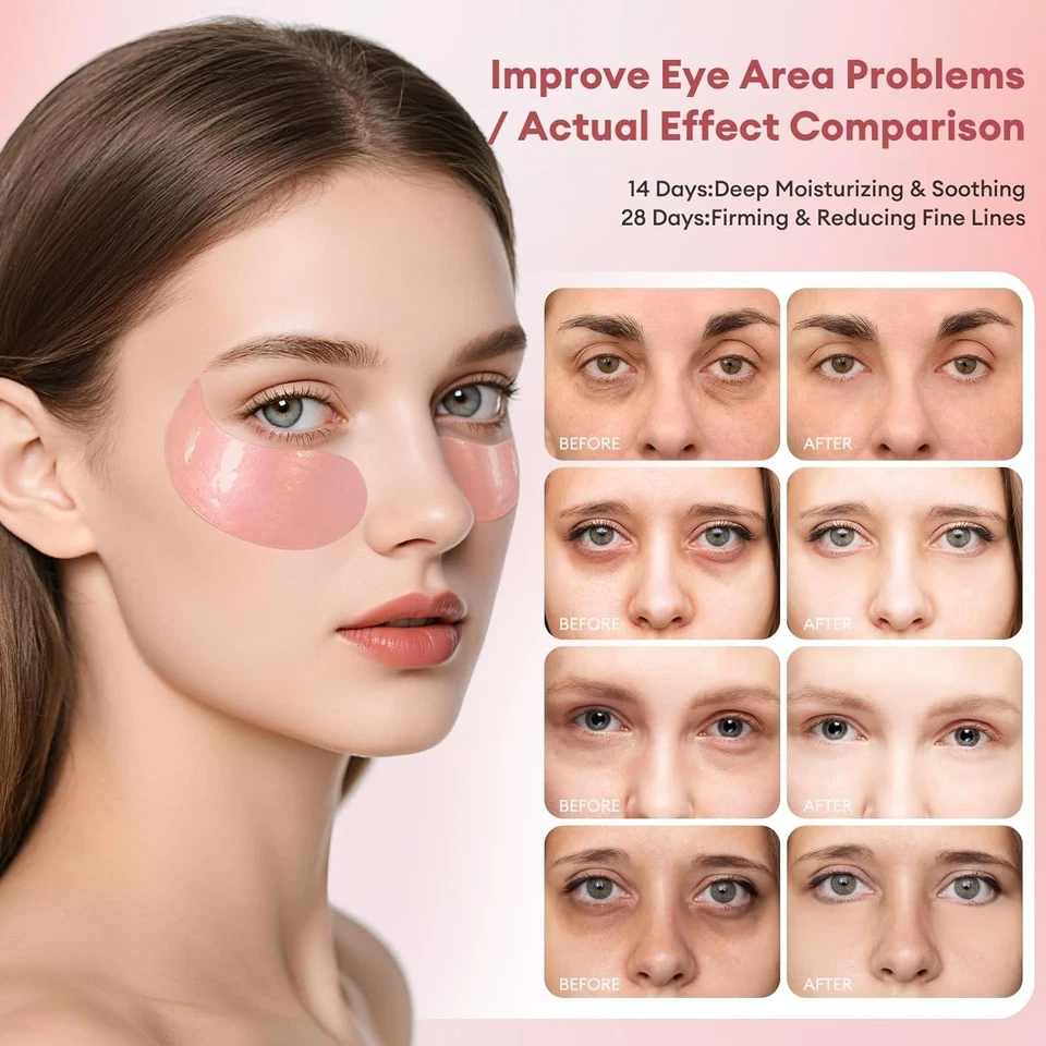 Gold Hydrogel Eye Patches for Dark Circles & Puffiness 60pcs Hydrating Mask - Image 3 of 4
