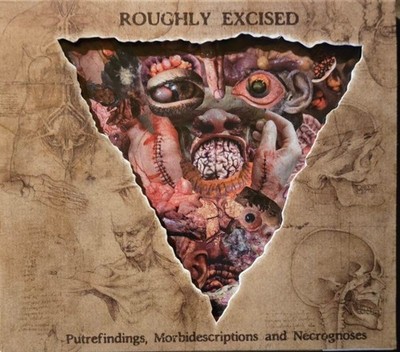 Lymphatic Phlegm - Roughly Excised(CD/2021)PUTREFACTION SETS IN PATHOLOGIST ROT