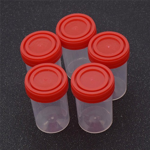 5/10 PIEZAS TAZA RECOLECCIÓN DE MUESTRAS DE ORINA HOSPITAL 60ML BOTELLAS OLLAS CONTENEDORES LA - Imagen 6 de 7
