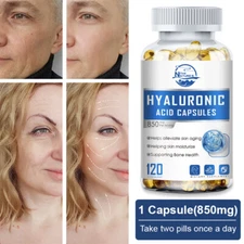 NATURE'S LIVE Hyaluronic Acid 120 mg 120 Capsules - Supports Healthy Joints/Skin