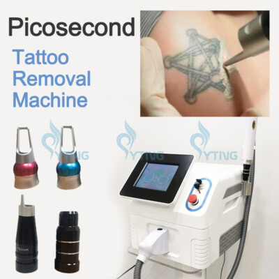 Nd YAG Laser Tattoo Removal Pigment Treatment Carbon Peel Picosecond machine