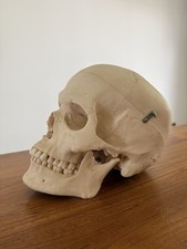 Original SOMSO Anatomie Schädelmodell - Top ...