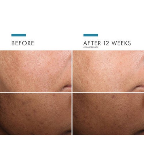 Skin Ceutical Discoloration Defense Dark Spot Corrector & Brightening 30ml AU - Picture 2 of 2