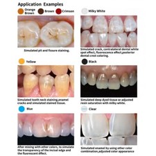1PC Dental 1.5g/Syringe Light Curing Flowable-Color Composite Resin Milky White