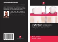 Mohit Sharma (U. A.) | Implantes Basculantes | Taschenbuch | Portugiesisch