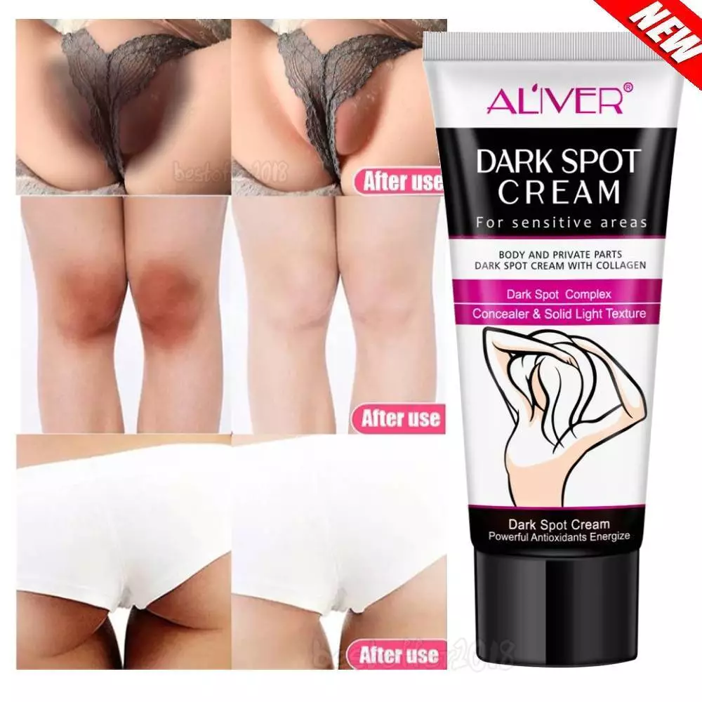 Whitening Cream Intimate Area Underarm Apmpit Legs Knees Dark Skin