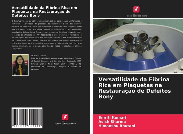 Versatilidade Da Fibrina Rica Em Plaquetas Na RestauraçãO De Defeitos Bony Smrit-image