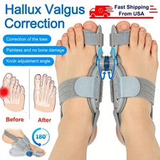 1 Pair 180° Bunion Corrector Silicone Toe Separator Straightener Orthopedic Toes