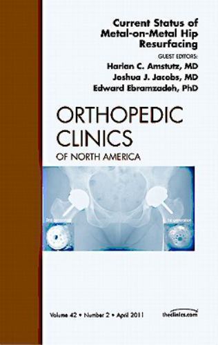 Current Status of Metal-on-Metal Hip Resurfacing, An Issue of Ortho… Volume 42-2