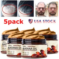 5X Natural Batana Oil Conditioner For Hair Growth Healthier Thicker Fuller Hair
