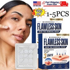1-5X Skin Tag Remover Patches Quick Effective Mole and Wart Pad Removal Sticker