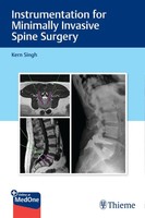 Kern Singh | Instrumentation For Minimally Invasive Spine Surgery | Bundle