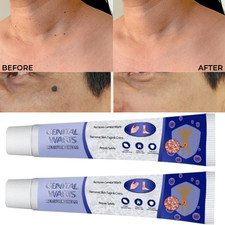 Ointment Cream by Genital use for removes dark spots and dullness 20 g Pack 2