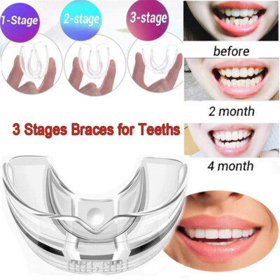 3 Stage Dental Orthodontic Teeth Corrector Braces Tooth Retainer Straighten Tool