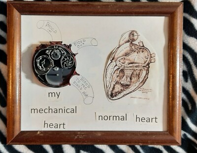 Art Mechanical Heart Very Rare