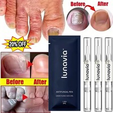15 Pack Lunavia Antifungal Pen, 25 Undecylenic Acid Toenail Fungus Treatment