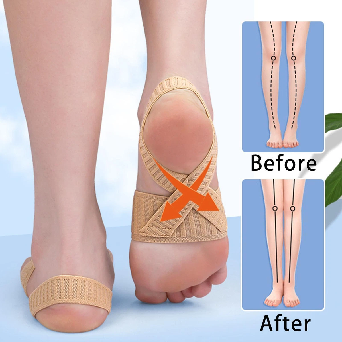 X brace hotsell foot and arch