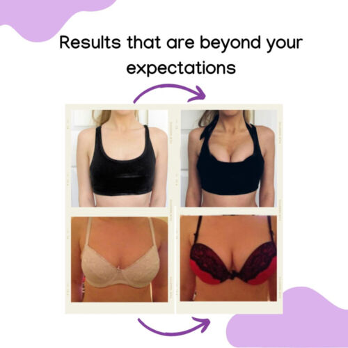 Strong Breast Growth Capsules 3400mg - Bust Enlargement, Female Estrogen Balance - Picture 6 of 9